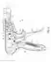 Fig. 30 - Suture clip deployment devices