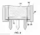 Fig. 04 - Systems and methods for mesh delivery and prevention of port-site hernia