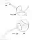 Fig. 23 - Systems and methods for mesh delivery and prevention of port-site hernia