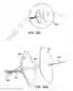 Fig. 28 - Systems and methods for mesh delivery and prevention of port-site hernia