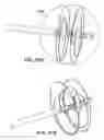 Fig. 37 - Systems and methods for mesh delivery and prevention of port-site hernia