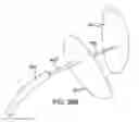 Fig. 41 - Systems and methods for mesh delivery and prevention of port-site hernia