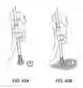 Fig. 48 - Systems and methods for mesh delivery and prevention of port-site hernia