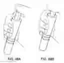 Fig. 55 - Systems and methods for mesh delivery and prevention of port-site hernia