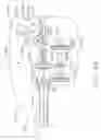 Fig. 80 - ROBOTICALLY-CONTROLLED END EFFECTOR