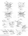 Fig. 02 - Surgical fastener