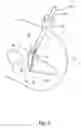 Fig. 08 - Articulation mechanisms for tissue specimen retrieval devices and tissue specimen retrieval devices incorporating the same