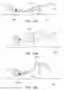Fig. 22 - Apparatus and method for vessel occlusion removal