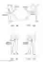 Fig. 02 - Method and apparatus for accessing the interior of a hip joint, including the provision and use of a novel telescoping access cannula and a novel telescoping obturator