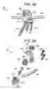 Fig. 03 - Multipoint fixation implants and related methods