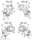 Fig. 05 - Multipoint fixation implants and related methods