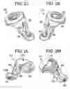 Fig. 07 - Multipoint fixation implants and related methods