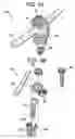 Fig. 08 - Multipoint fixation implants and related methods