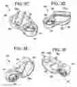 Fig. 09 - Multipoint fixation implants and related methods