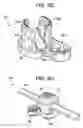Fig. 10 - Multipoint fixation implants and related methods