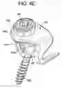 Fig. 14 - Multipoint fixation implants and related methods