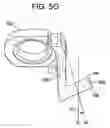 Fig. 18 - Multipoint fixation implants and related methods