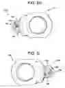 Fig. 19 - Multipoint fixation implants and related methods