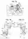 Fig. 22 - Multipoint fixation implants and related methods
