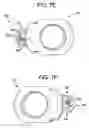 Fig. 24 - Multipoint fixation implants and related methods