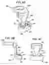 Fig. 25 - Multipoint fixation implants and related methods