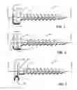 Fig. 02 - Anchors for vertebral body