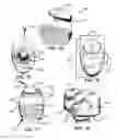 Fig. 06 - Anchors for vertebral body