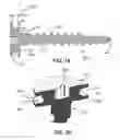 Fig. 07 - Anchors for vertebral body