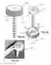 Fig. 22 - Anchors for vertebral body