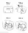 Fig. 02 - Method and instruments for interbody fusion and posterior fixation through a single incision