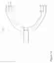 Fig. 15 - Resiliant spinal plate system