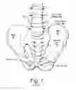 Fig. 02 - Surgical fastener manipulation tool