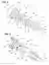 Fig. 04 - Surgical fastener manipulation tool