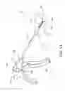 Fig. 02 - Transversely displacing structures in the body