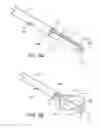 Fig. 09 - Transversely displacing structures in the body