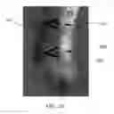 Fig. 12 - System and method for controlling energy delivered to an area of tissue during a treatment procedure