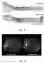 Fig. 18 - System and method for controlling energy delivered to an area of tissue during a treatment procedure
