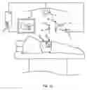 Fig. 02 - Attachment Component, Navigation System and Method for Tracking a Surgical Instrument