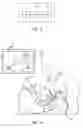 Fig. 06 - Attachment Component, Navigation System and Method for Tracking a Surgical Instrument