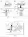 Fig. 07 - Attachment Component, Navigation System and Method for Tracking a Surgical Instrument