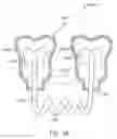 Fig. 28 - Methods for fabricating orthodontic appliances with power arms