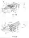 Fig. 19 - Expandable implant assembly
