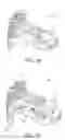 Fig. 23 - Expandable implant assembly
