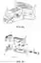 Fig. 24 - Expandable implant assembly