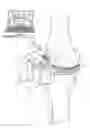 Fig. 01 - Surgical apparatus to support installation of a prosthetic component and method therefore