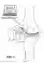 Fig. 02 - Surgical apparatus to support installation of a prosthetic component and method therefore