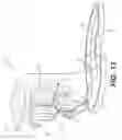 Fig. 07 - Surgical apparatus to support installation of a prosthetic component and method therefore
