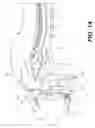 Fig. 08 - Surgical apparatus to support installation of a prosthetic component and method therefore