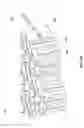 Fig. 79 - Negative pressure wound closure device