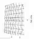 Fig. 83 - Negative pressure wound closure device